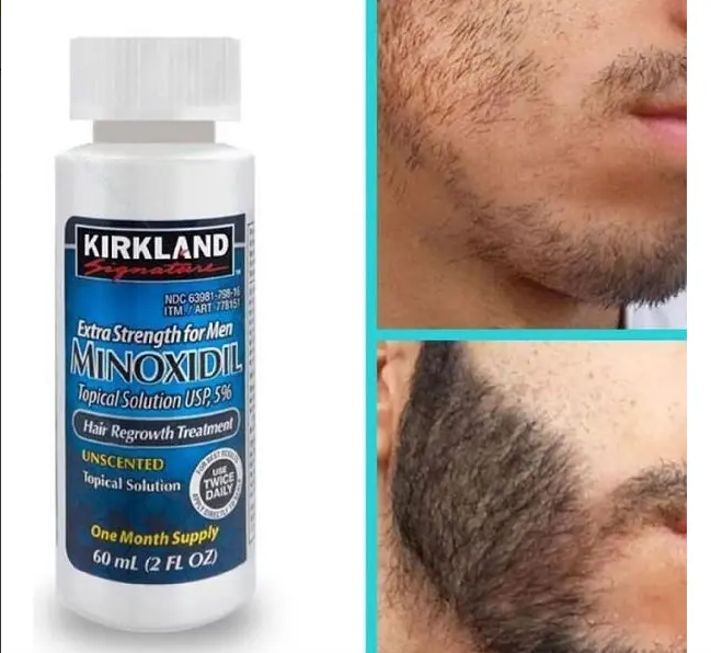 Miniatura de referencia visual del Minoxidil Kirkland